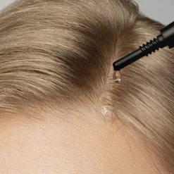 SCALP Peel Serum, 50 ml