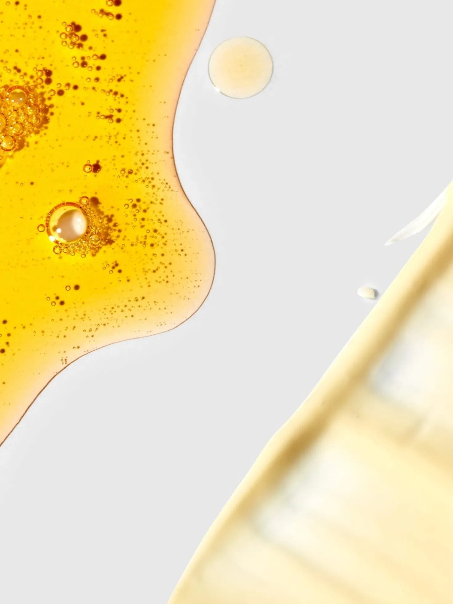 The Gemini Stretch Mark Dual System